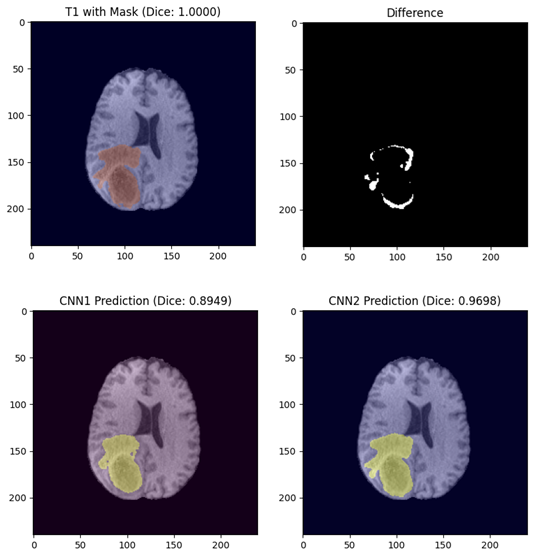 Brain Tumor Segmentation Results Preview